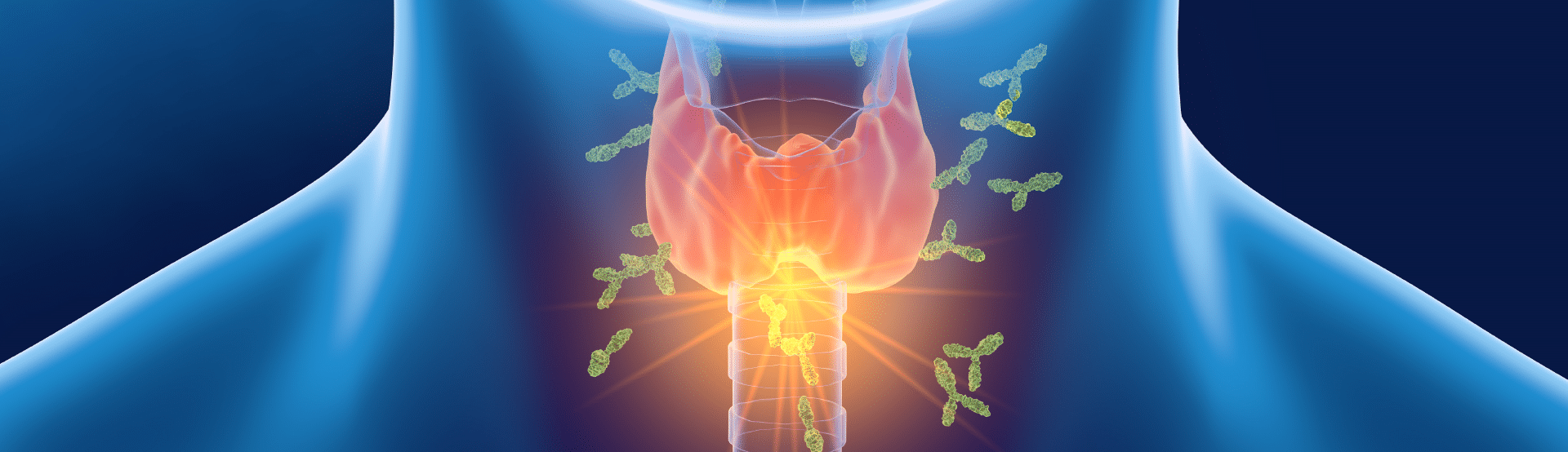 Vitiligine e tiroidite di Hashimoto