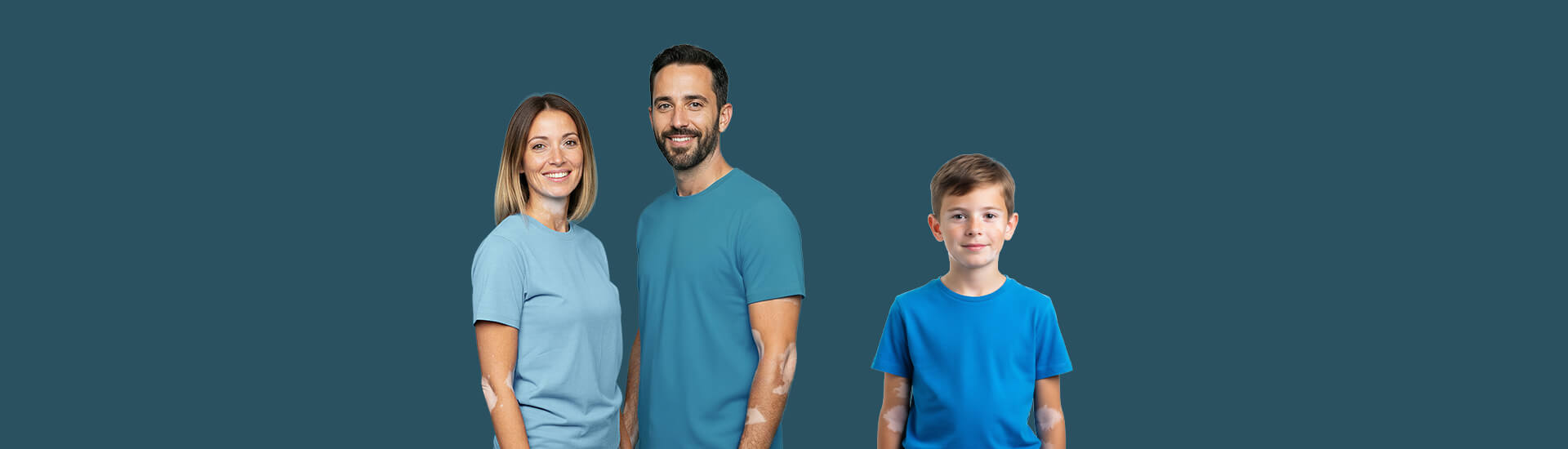 Vitiligine: una malattia autoimmune con radici sistemiche