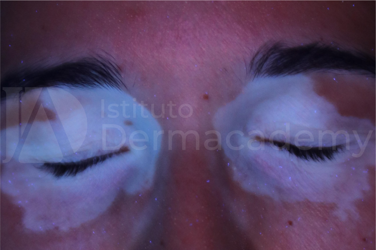 TC prima