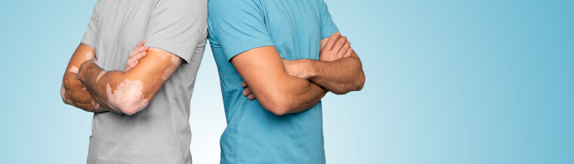 La vitiligine si può curare?